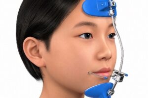 위턱의 앞쪽 성장을 유도하는 성장기 교정 페이스마스크 착용 모습
