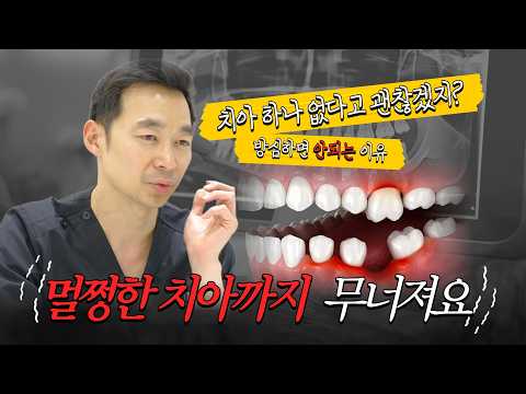 이 뺀 자리, 그냥 두면 어떻게 될까? 나중엔 임플란트도 바로 못 할 수 있습니다 #기흥치과
